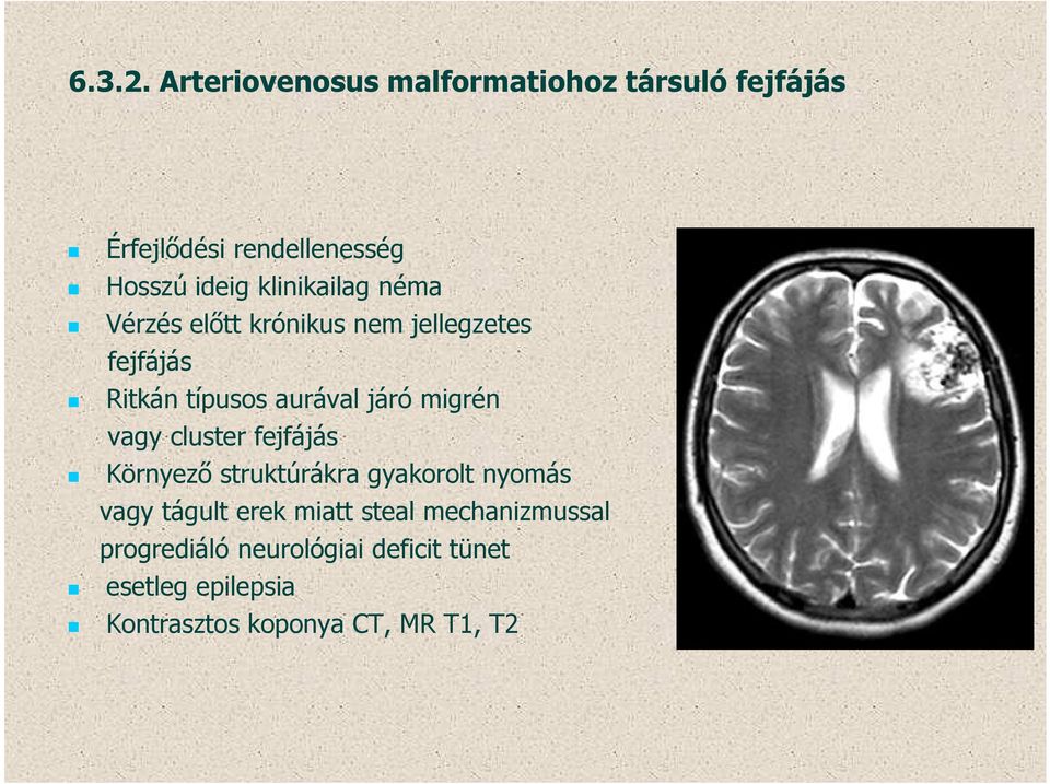 klinikailag néma Vérzés előtt krónikus nem jellegzetes fejfájás Ritkán típusos aurával járó