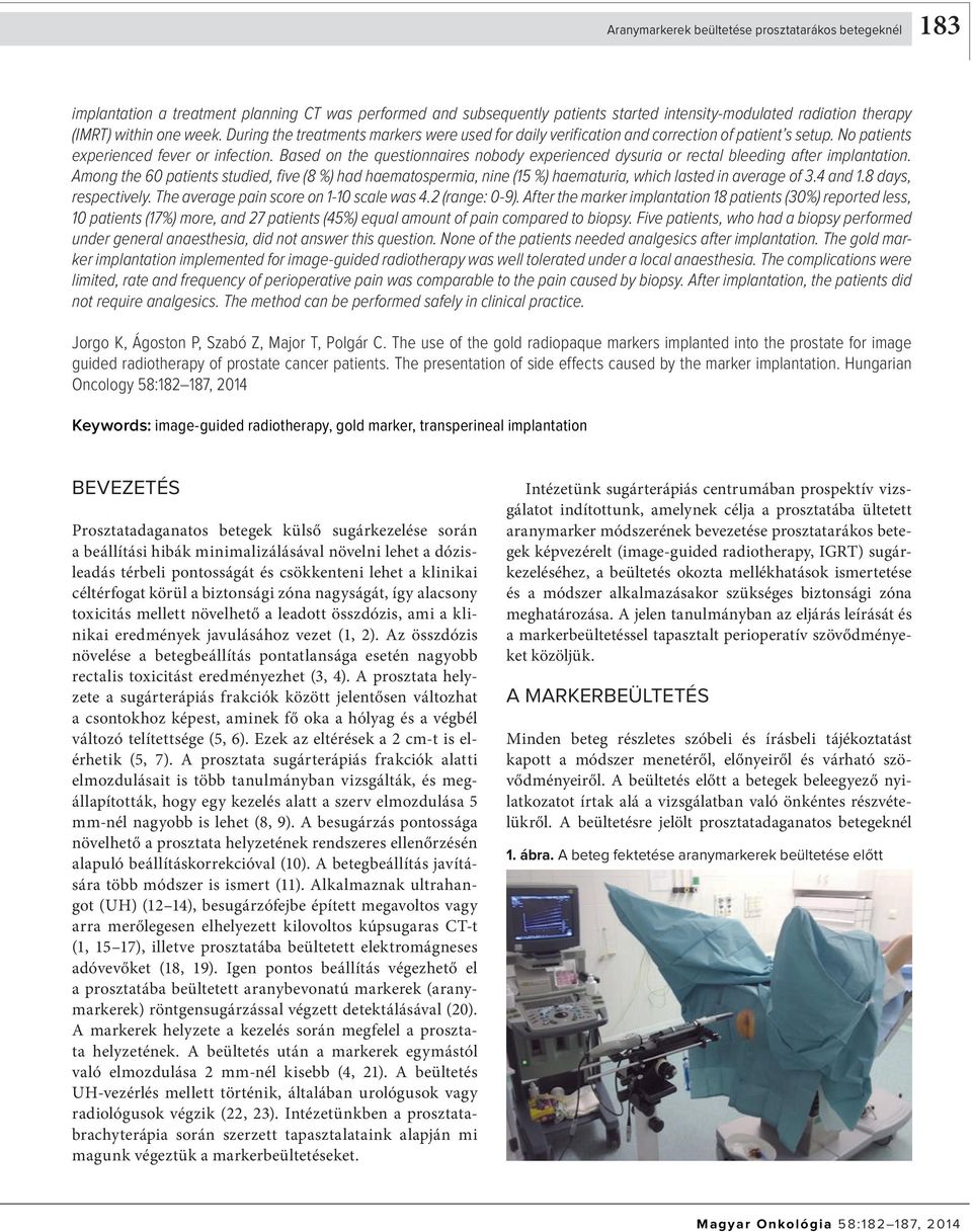 Based on the questionnaires nobody experienced dysuria or rectal bleeding after implantation.