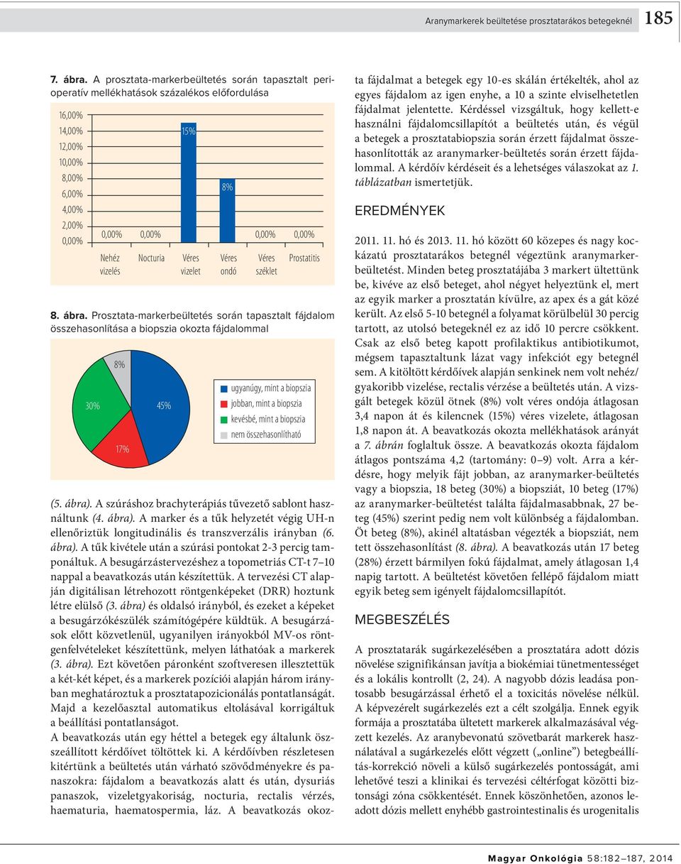 Prosztata-markerbeültetés során tapasztalt fájdalom összehasonlítása a biopszia okozta fájdalommal 30% 8% 17% 45% 15% Nehéz Nocturia Véres Véres Véres Prostatitis vizelés vizelet ondó széklet