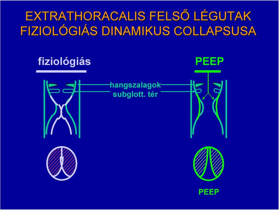 DINAMIKUS COLLAPSUSA