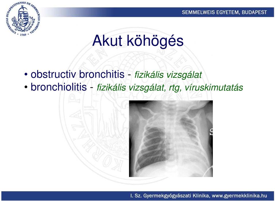 vizsgálat bronchiolitis -