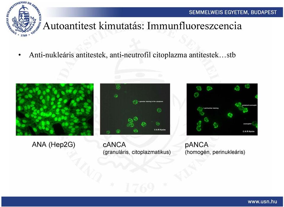 citoplazma antitestek stb ANA (Hep2G) canca