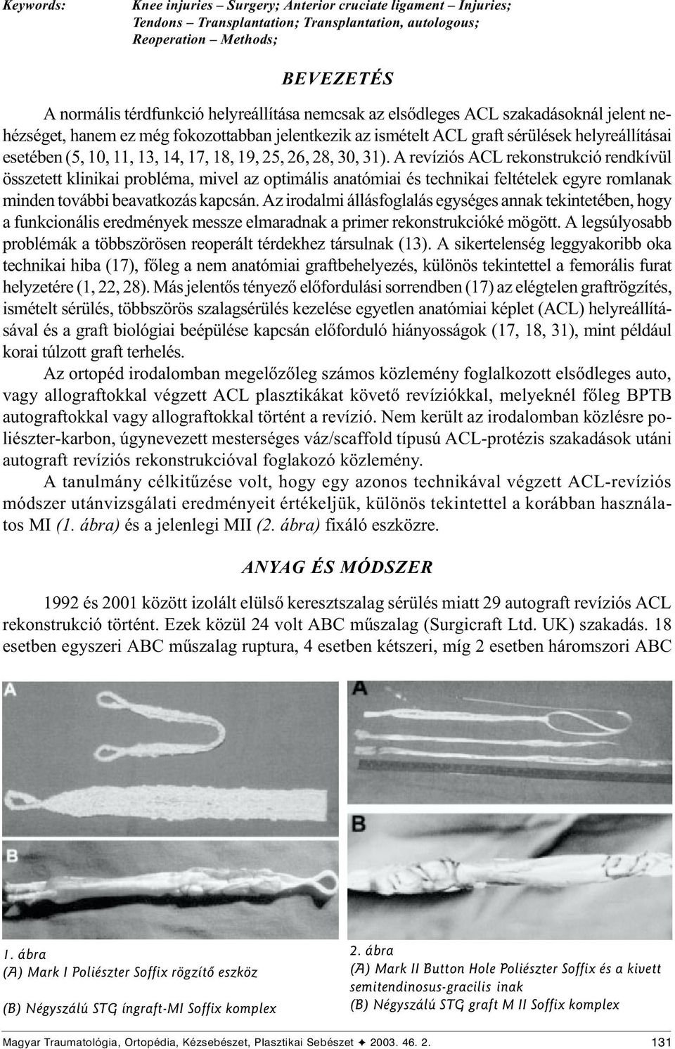 30, 31). A revíziós ACL rekonstrukció rendkívül összetett klinikai probléma, mivel az optimális anatómiai és technikai feltételek egyre romlanak minden további beavatkozás kapcsán.