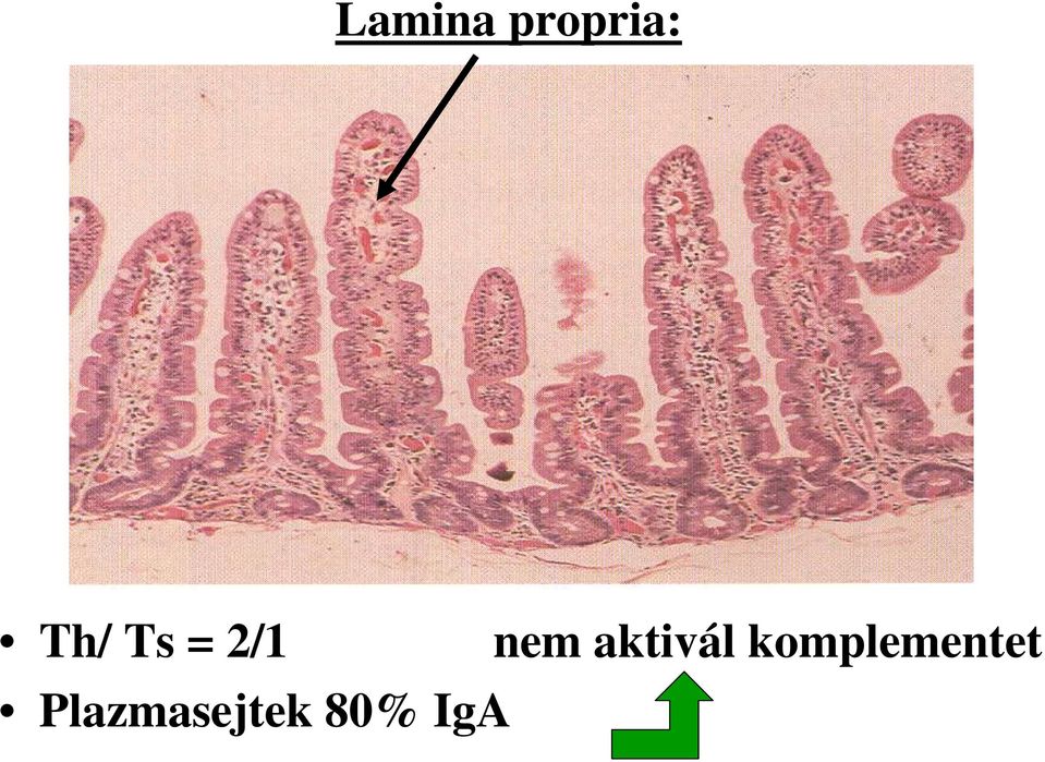 aktivál