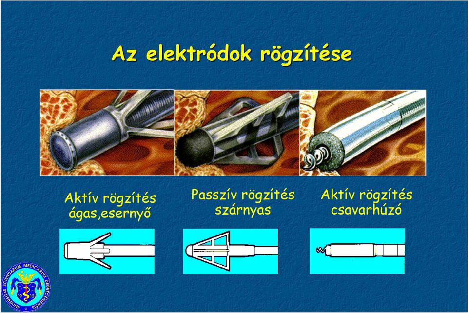 ágas,esernyő Passzív