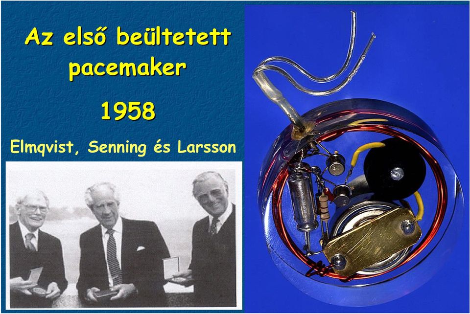 pacemaker 1958