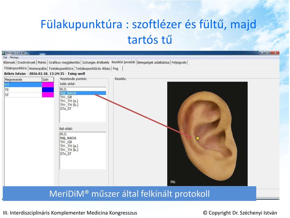 majd tartós tű MeriDiM