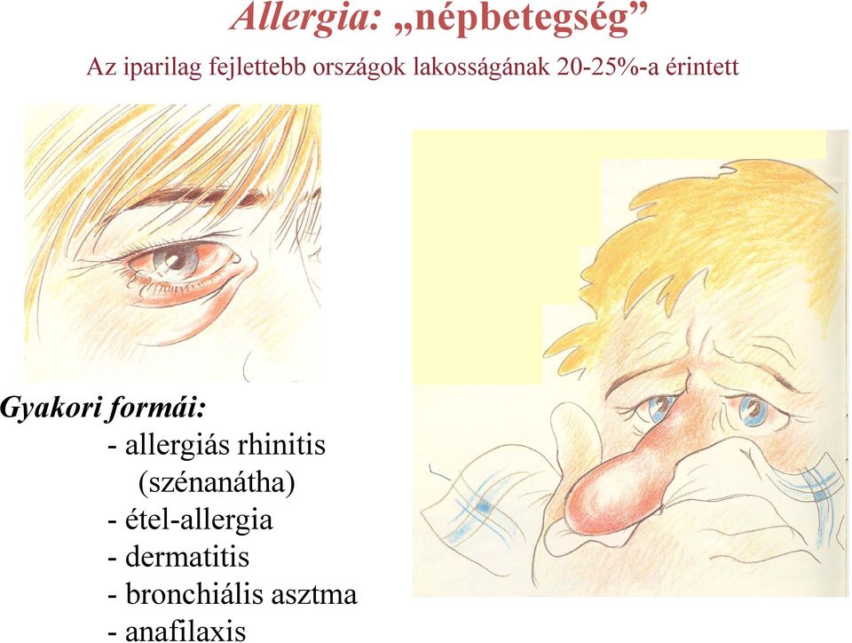 formái: - allergiás rhinitis (szénanátha) -