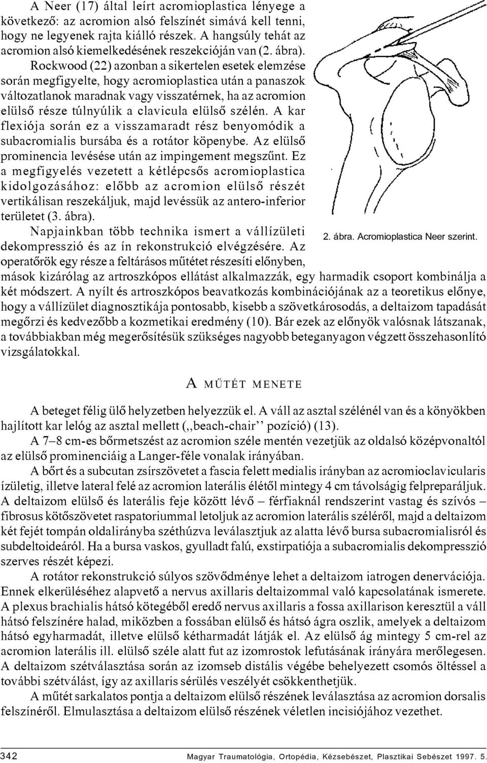 Rockwood (22) azonban a sikertelen esetek elemzése során megfigyelte, hogy acromioplastica után a panaszok változatlanok maradnak vagy visszatérnek, ha az acromion elülsô része túlnyúlik a clavicula