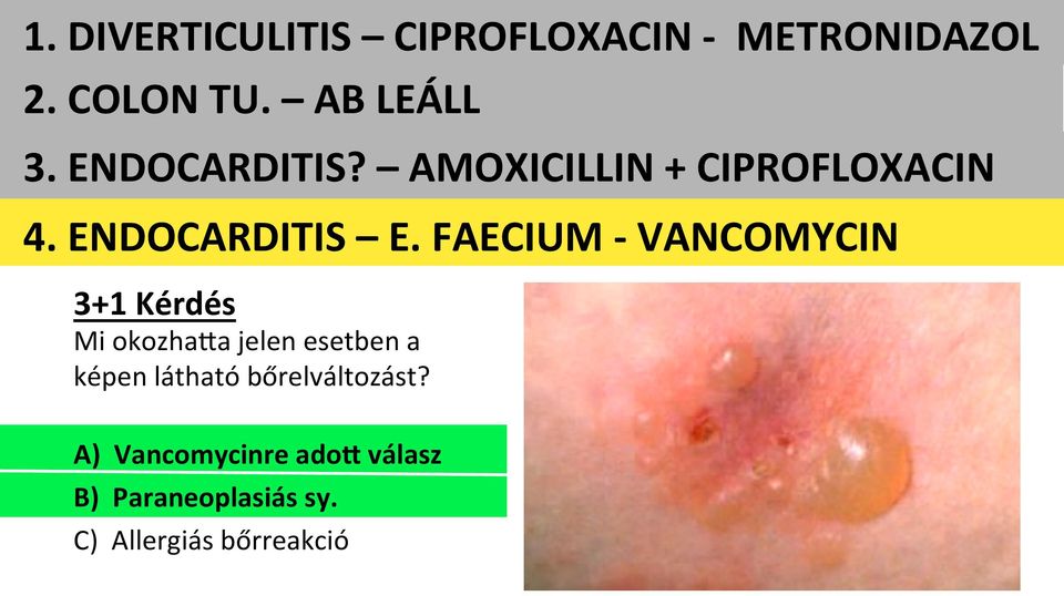 FAECIUM - VANCOMYCIN 3+1 Kérdés Mi okozhasa jelen esetben a képen látható