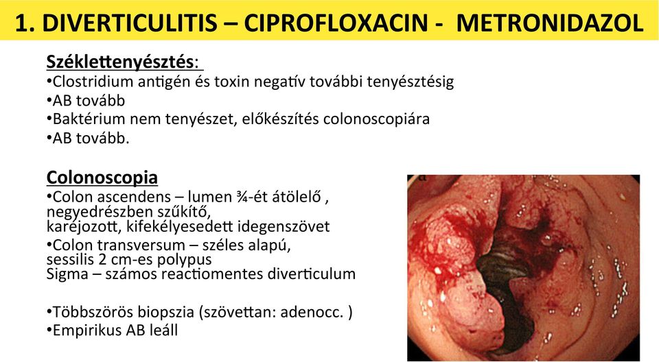 Colonoscopia Colon ascendens lumen ¾-ét átölelő, negyedrészben szűkítő, karéjozos, kifekélyesedes idegenszövet