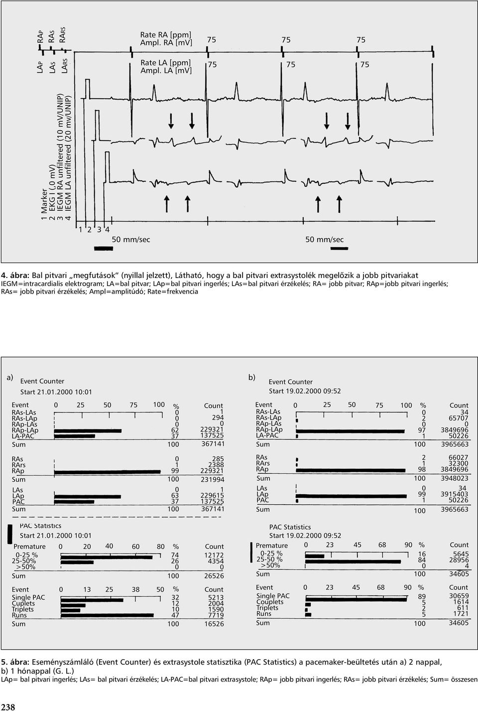 Rate=frekvencia 5. ábra: Eseményszámláló (Event Counter) és extrasystole statisztika (PAC Statistics) a pacemaker-beültetés után a) 2 nappal, b) 1 hónappal (G.