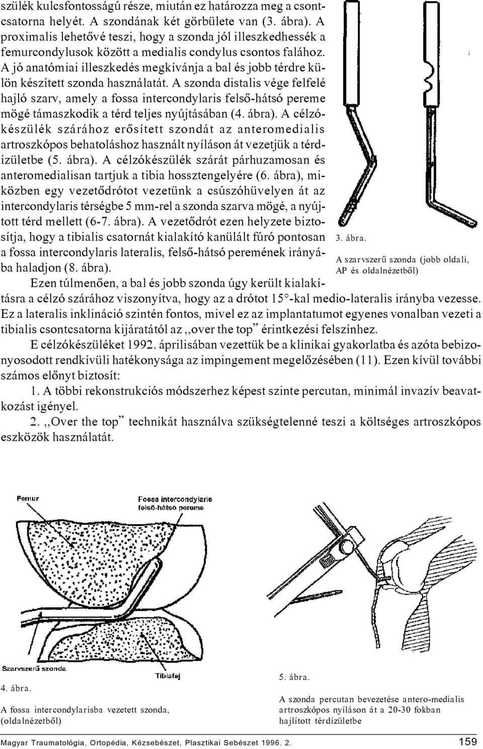 A jó anatómiai illeszkedés megkívánja a bal és jobb térdre külön készített szonda használatát.