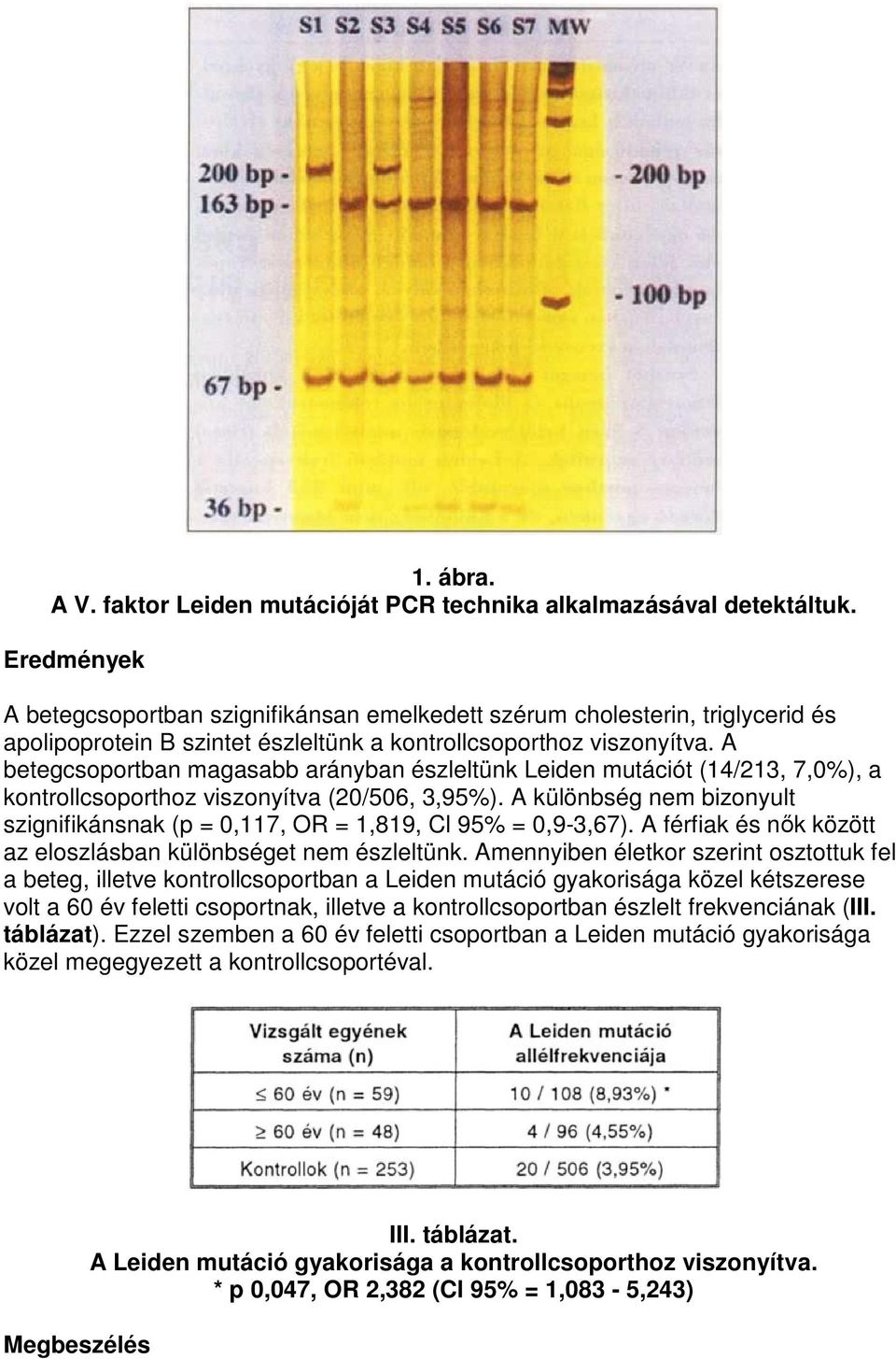 A betegcsoportban magasabb arányban észleltünk Leiden mutációt (14/213, 7,0%), a kontrollcsoporthoz viszonyítva (20/506, 3,95%).