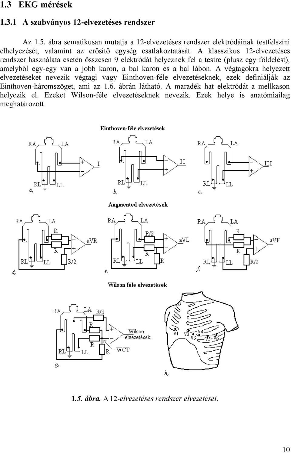 A klasszikus 1-elvezetéses rendszer használata esetén összesen 9 elektródát helyeznek fel a testre (plusz egy földelést), amelyből egy-egy van a jobb karon, a bal karon és a bal lábon.