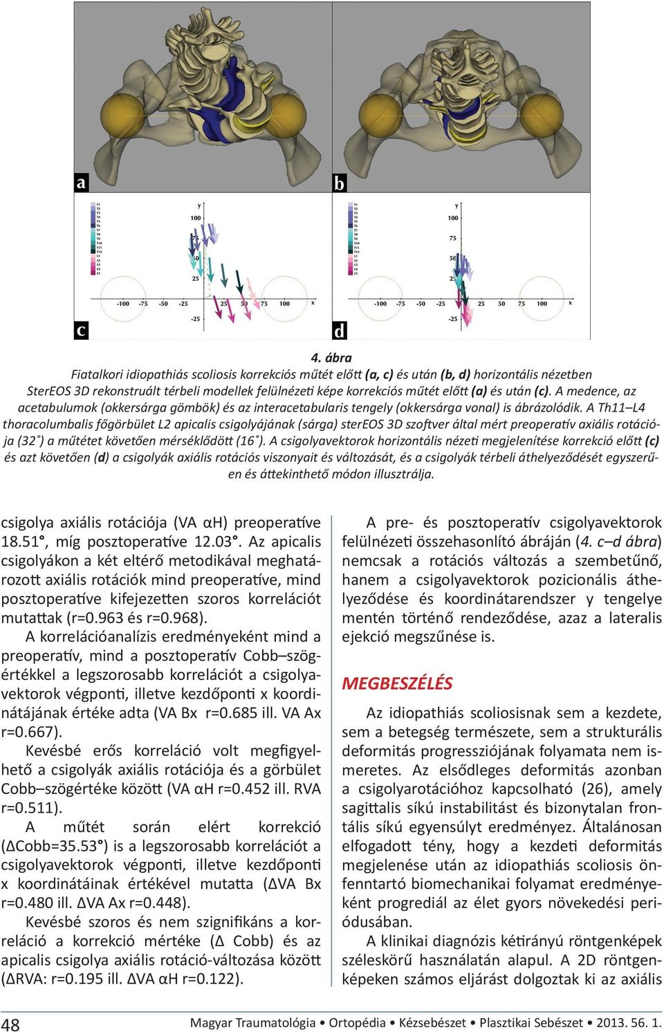 A Th11 L4 thoracolumbalis főgörbület L2 apicalis csigolyájának (sárga) stereos 3D szo ver által mért preopera v axiális rotációja (32 ) a műtétet követően mérséklődö (16 ).