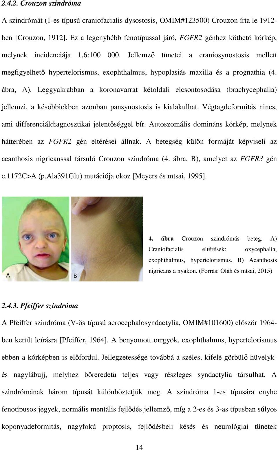 Jellemző tünetei a craniosynostosis mellett megfigyelhető hypertelorismus, exophthalmus, hypoplasiás maxilla és a prognathia (4. ábra, A).