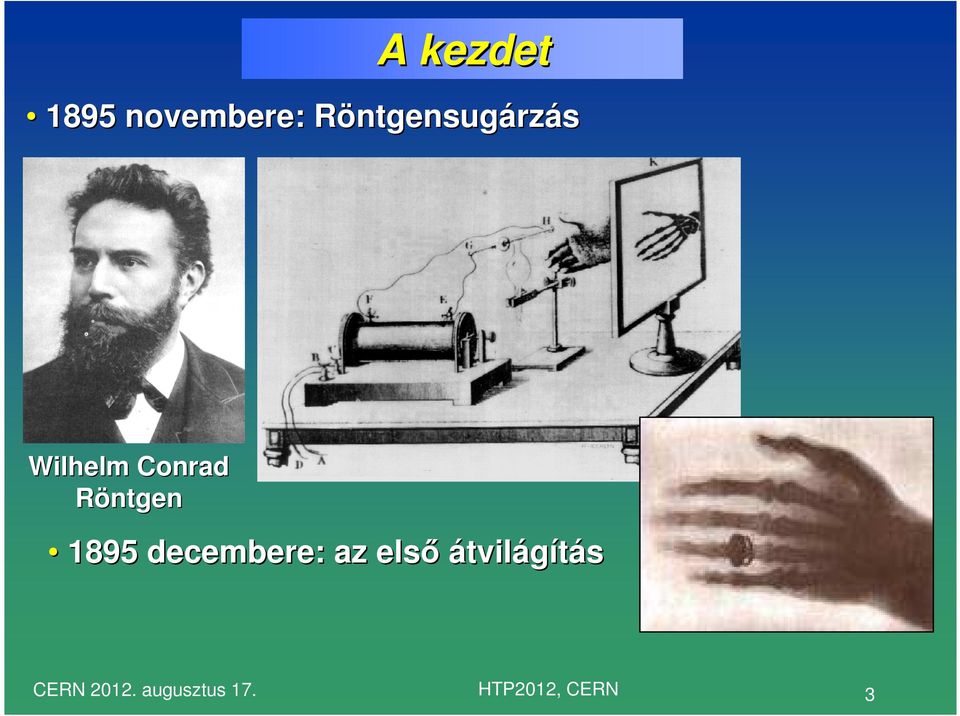 Röntgen 1895 decembere: az elsı