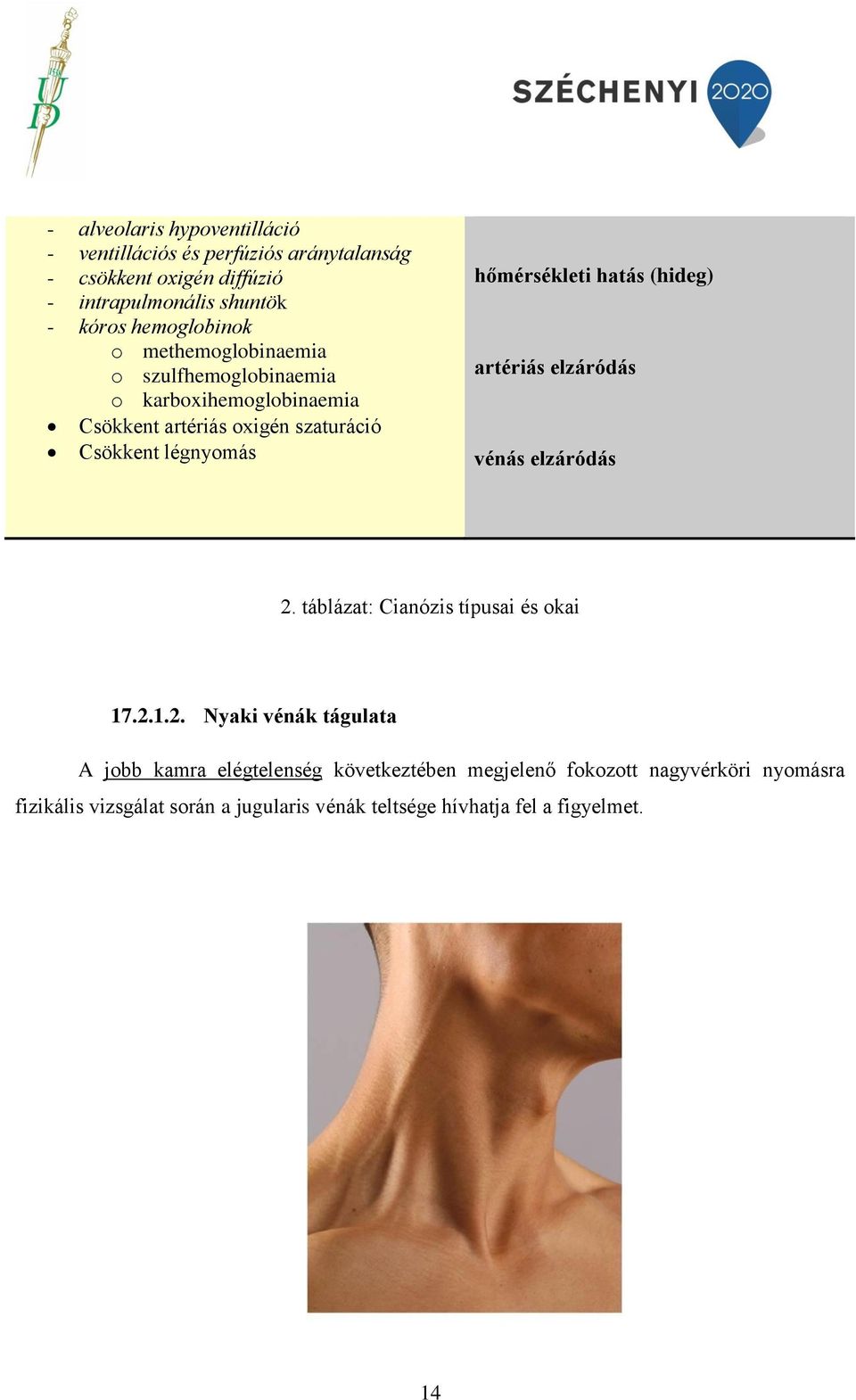 hőmérsékleti hatás (hideg) artériás elzáródás vénás elzáródás 2.