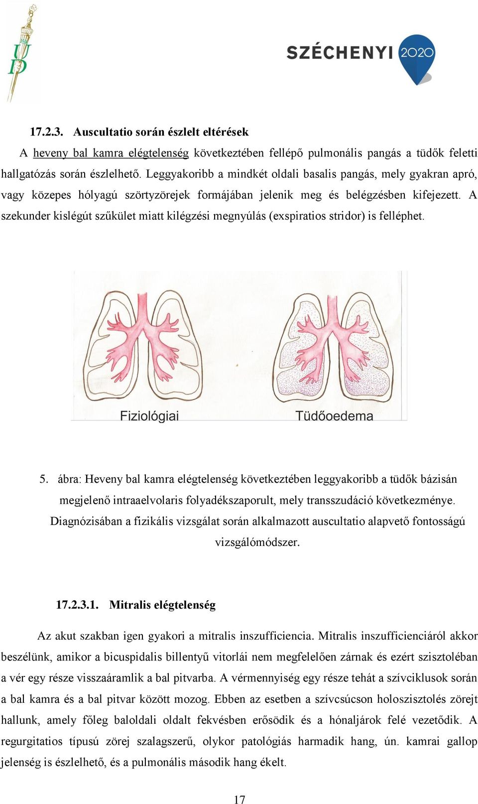 A szekunder kislégút szűkület miatt kilégzési megnyúlás (exspiratios stridor) is felléphet. 5.