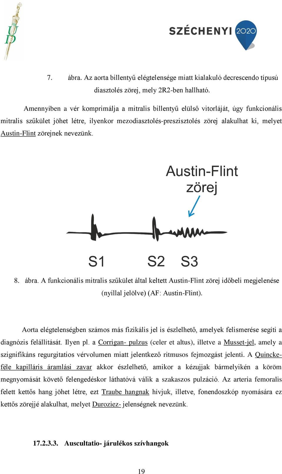 zörejnek nevezünk. 8. ábra. A funkcionális mitralis szűkület által keltett Austin-Flint zörej időbeli megjelenése (nyíllal jelölve) (AF: Austin-Flint).