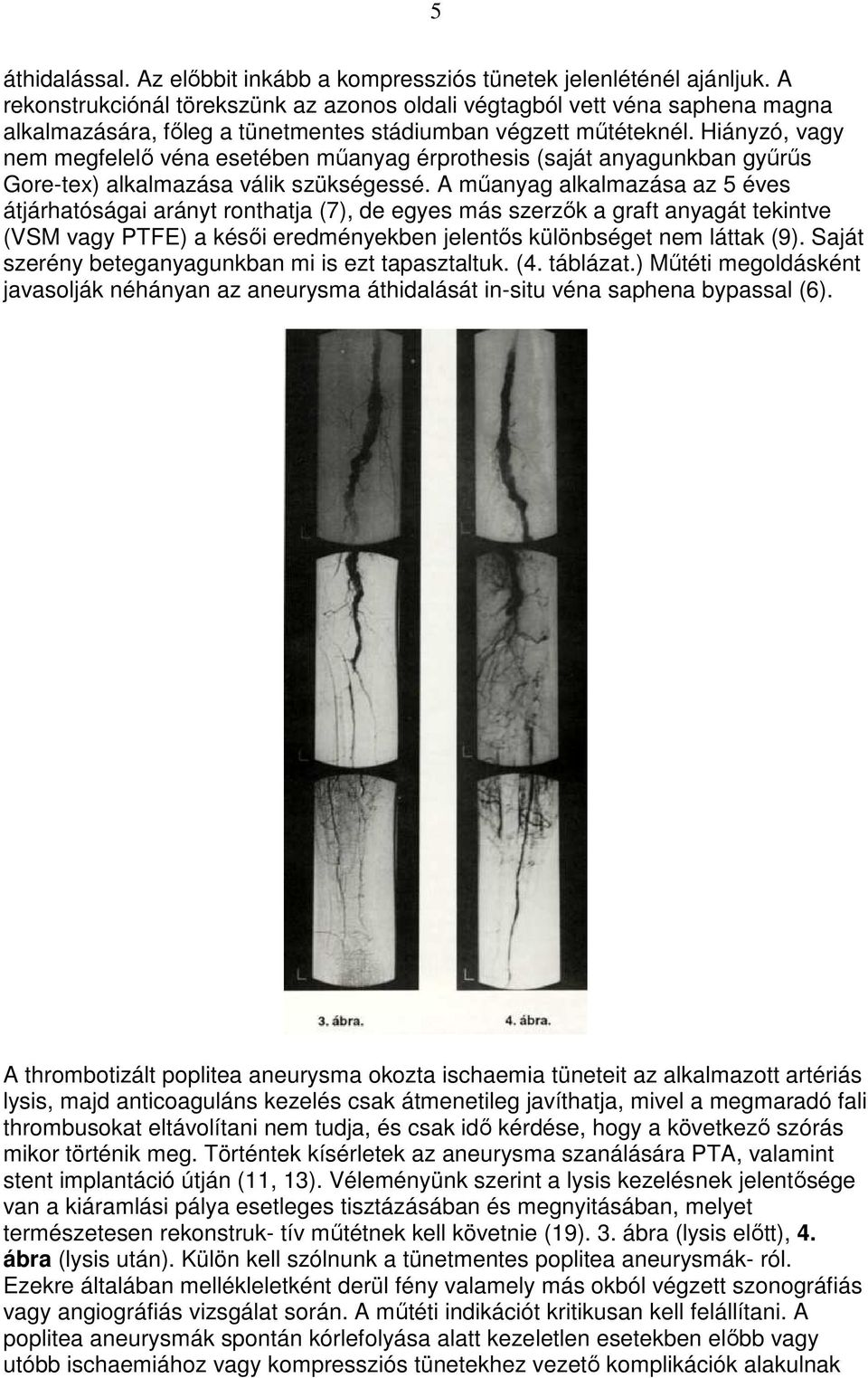 Hiányzó, vagy nem megfelelı véna esetében mőanyag érprothesis (saját anyagunkban győrős Gore-tex) alkalmazása válik szükségessé.