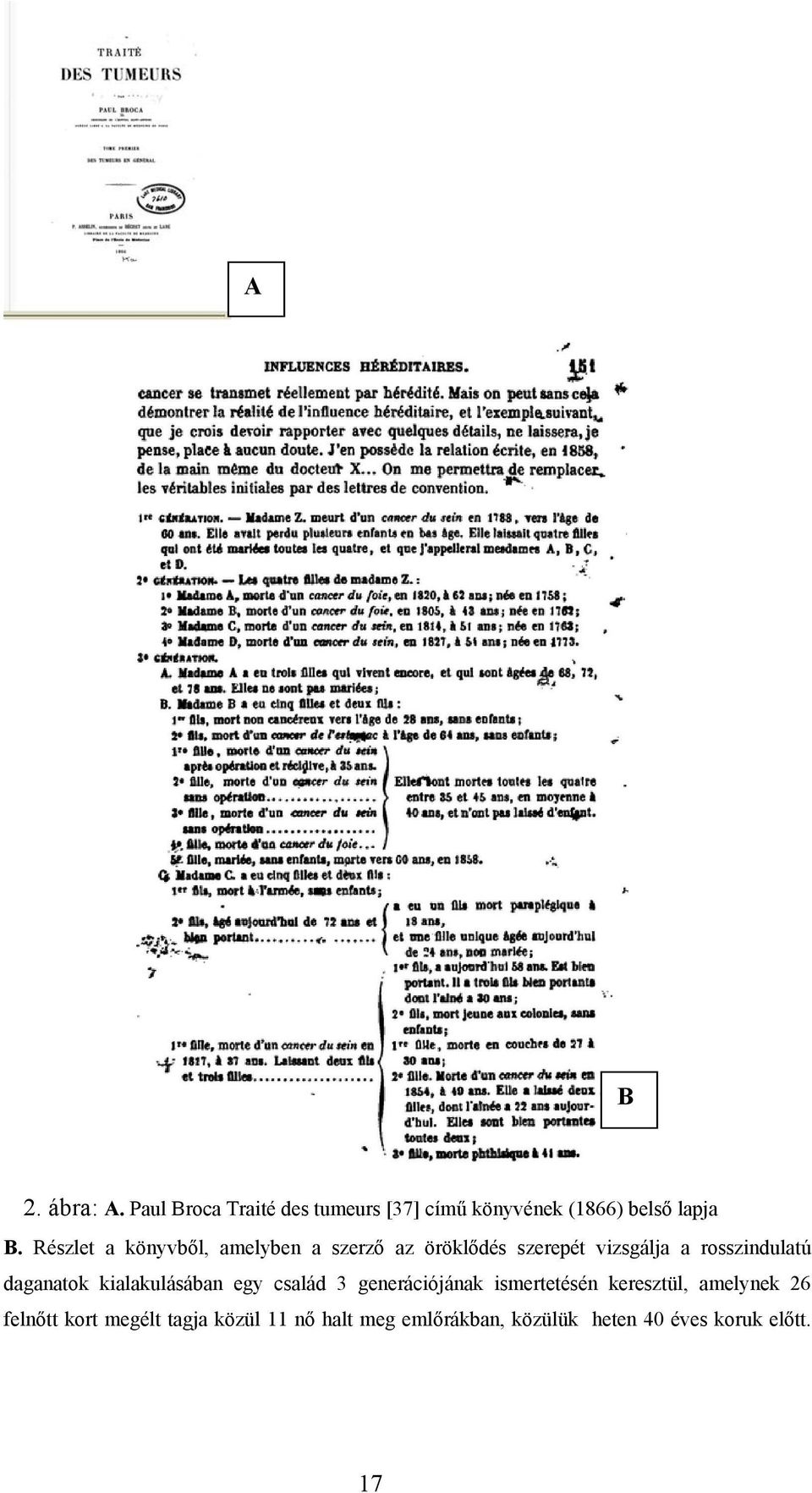 daganatok kialakulásában egy család 3 generációjának ismertetésén keresztül, amelynek 26