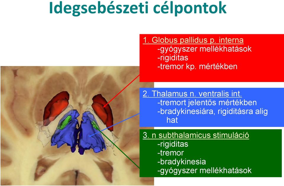 Thalamus n. ventralis int.