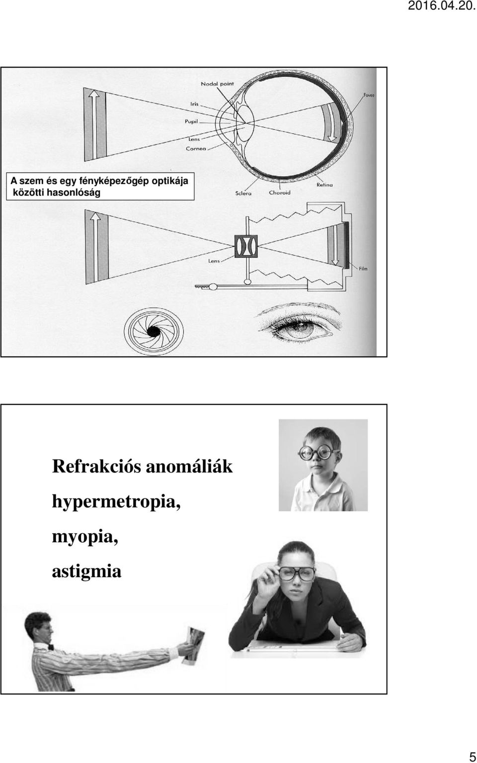 Refrakciós anomáliák