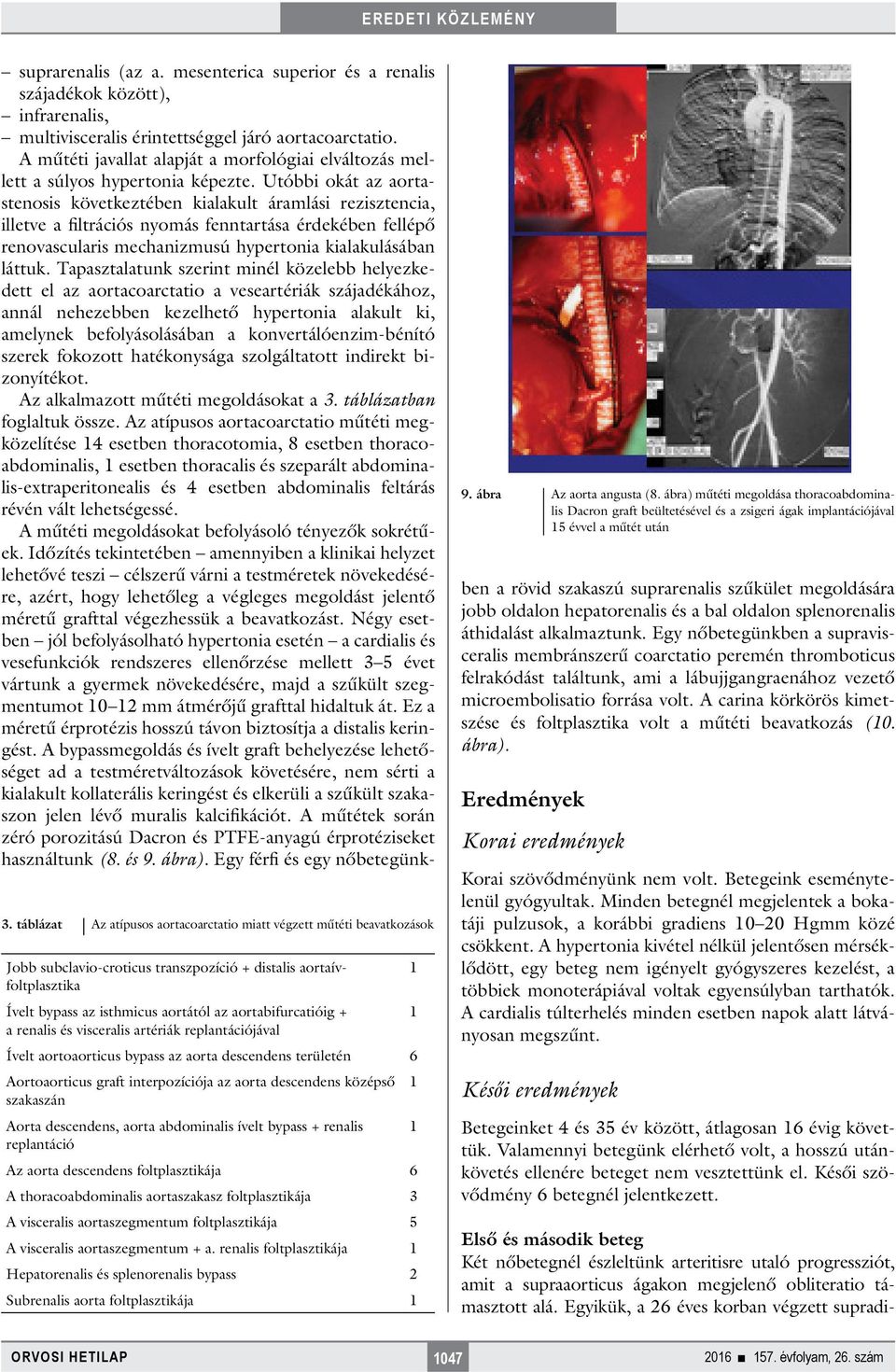 szakaszán Aorta descendens, aorta abdominalis ívelt bypass + renalis replantáció Az aorta descendens foltplasztikája 6 A thoracoabdominalis aortaszakasz foltplasztikája 3 A visceralis aortaszegmentum