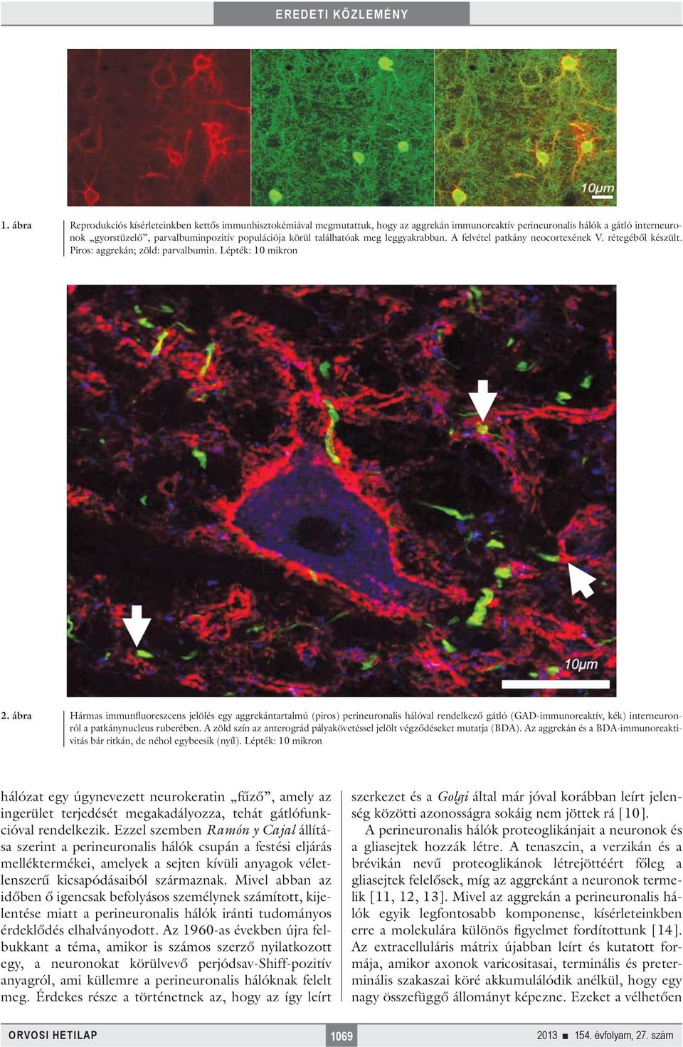 ábra Hármas immunfluoreszcens jelölés egy aggrekántartalmú (piros) perineuronalis hálóval rendelkező gátló (GAD-immunoreaktív, kék) interneuronról a patkánynucleus ruberében.