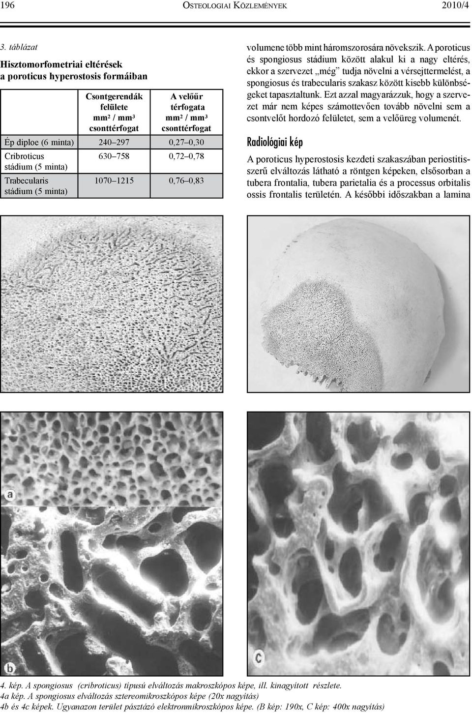 0,30 Cribroticus stádium (5 minta) Trabecularis stádium (5 minta) 630 758 0,72 0,78 1070 1215 0,76 0,83 volumene több mint háromszorosára növekszik.