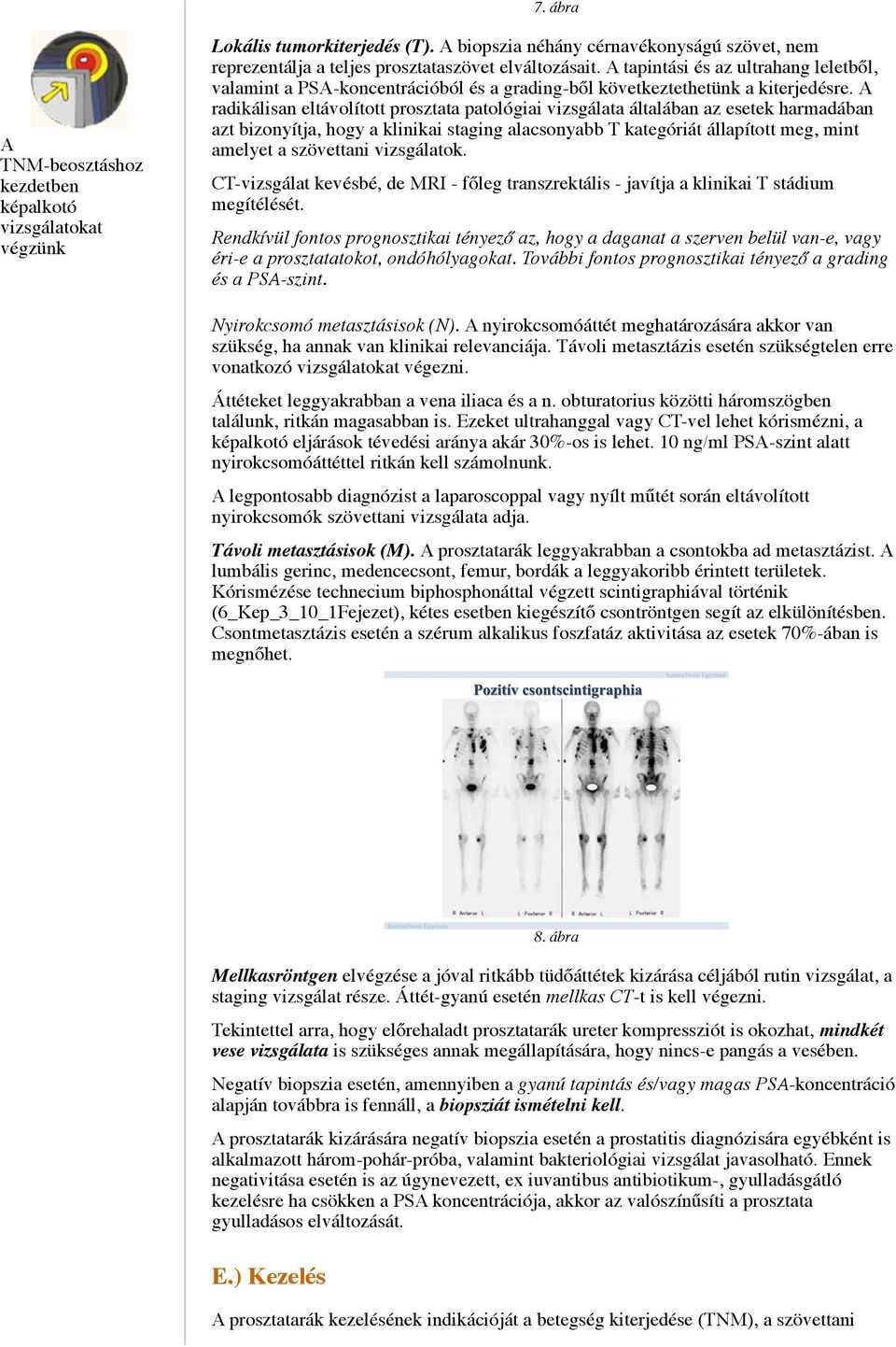 A radikálisan eltávolított prosztata patológiai vizsgálata általában az esetek harmadában azt bizonyítja, hogy a klinikai staging alacsonyabb T kategóriát állapított meg, mint amelyet a szövettani