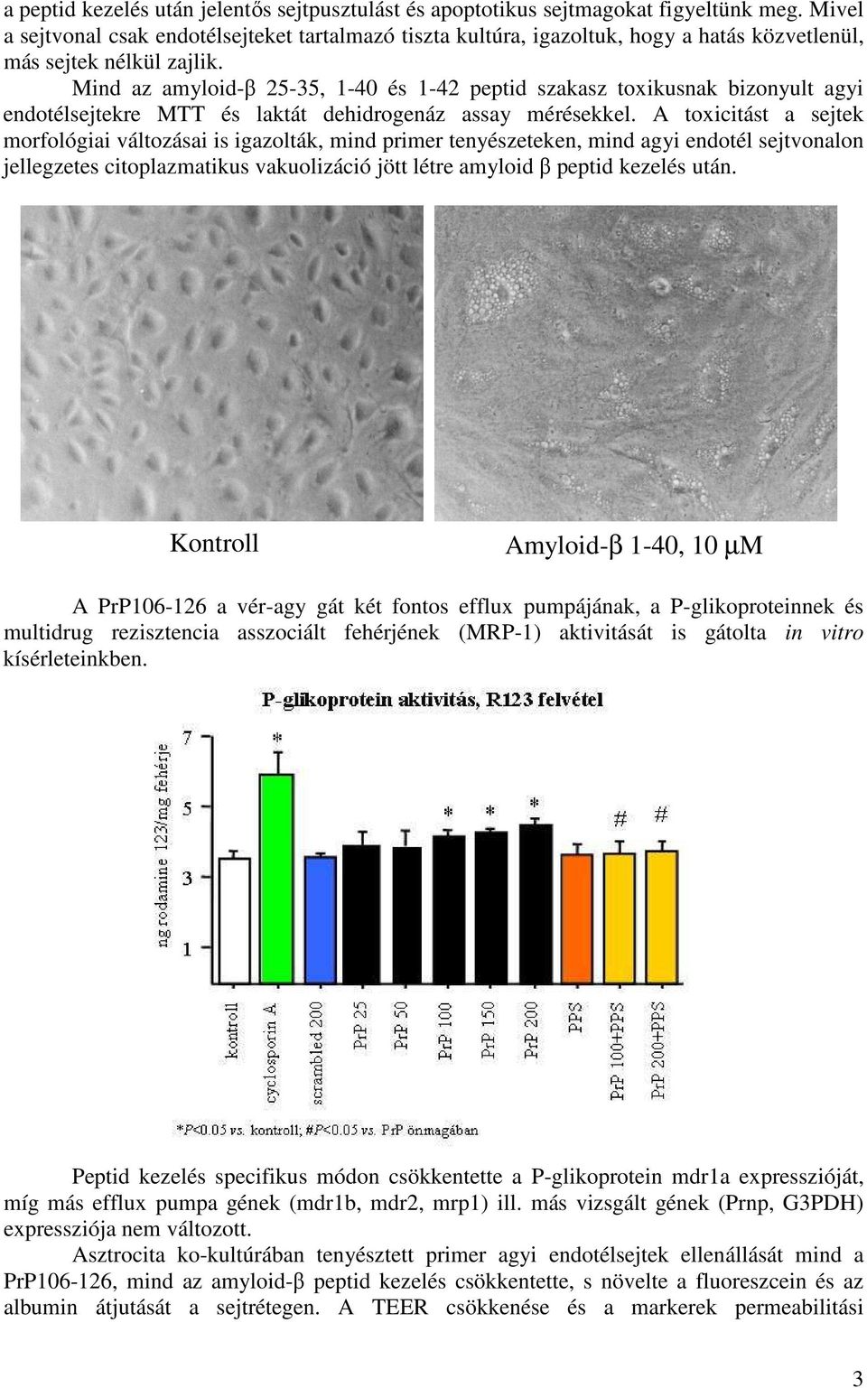 Mind az amyloid-β 25-35, 1-40 és 1-42 peptid szakasz toxikusnak bizonyult agyi endotélsejtekre MTT és laktát dehidrogenáz assay mérésekkel.