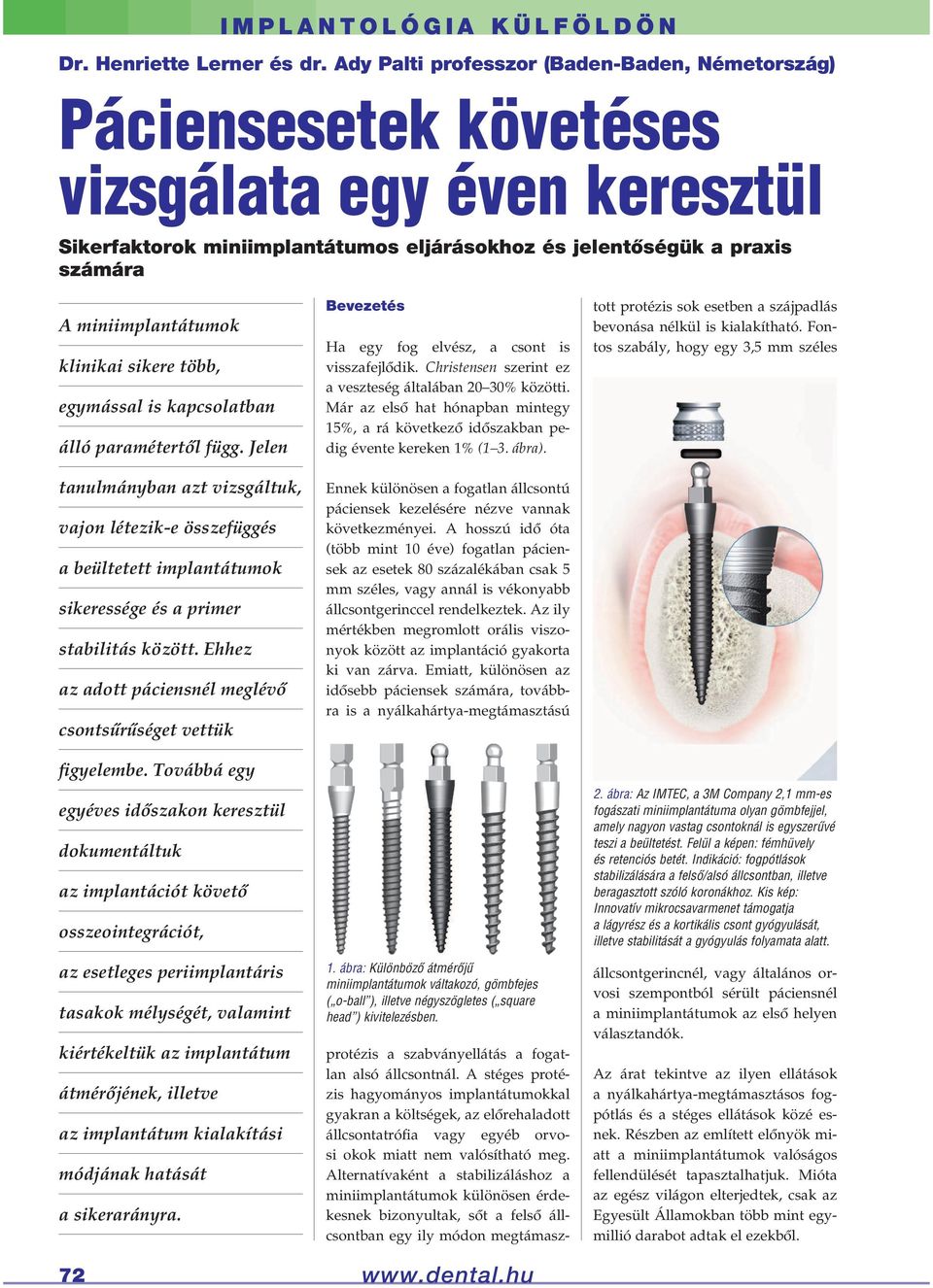 paramétertôl függ. Jelen tanulmányban azt vizsgáltuk, vajon létezik-e összefüggés a beültetett implantátumok sikeressége és a primer stabilitás között.