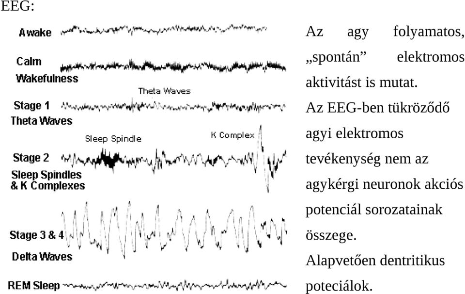 Az EEG-ben tükröződő agyi elektromos tevékenység nem