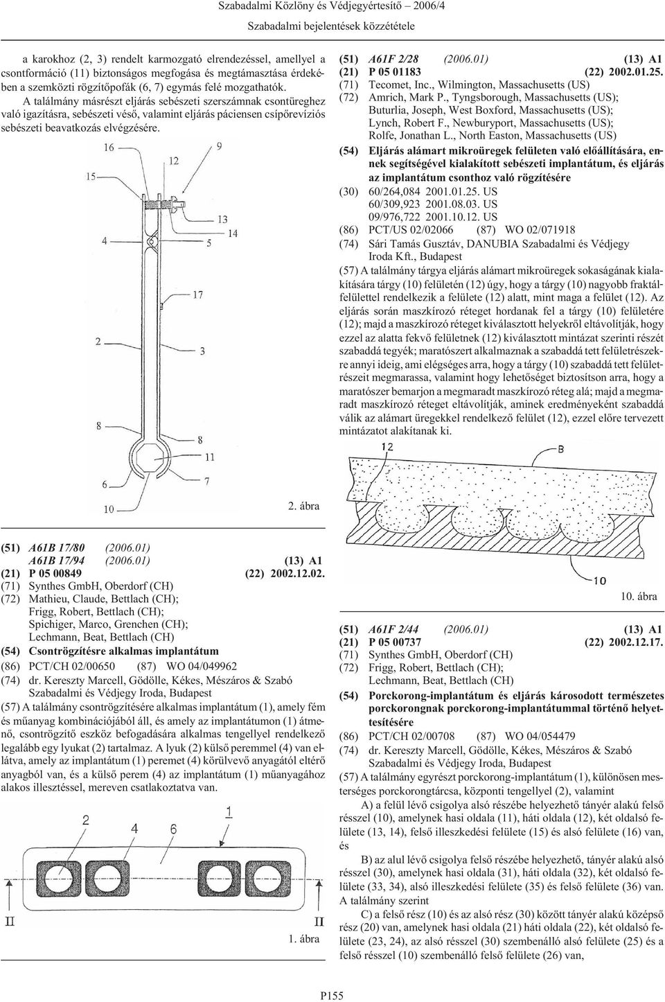 01) (13) A1 (21) P 05 01183 (22) 2002.01.25. (71) Tecomet, Inc., Wilmington, Massachusetts (US) (72) Amrich, Mark P.