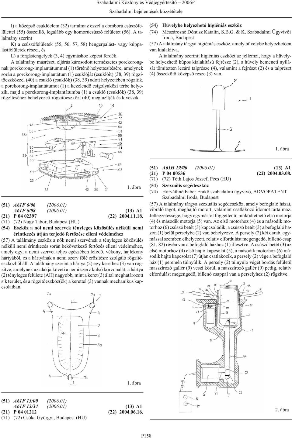 A találmány másrészt, eljárás károsodott természetes porckorongnak porckorong-implantátummal (1) történõ helyettesítésére, amelynek során a porckorong-implantátum (1) csuklóját (csuklóit) (38, 39)