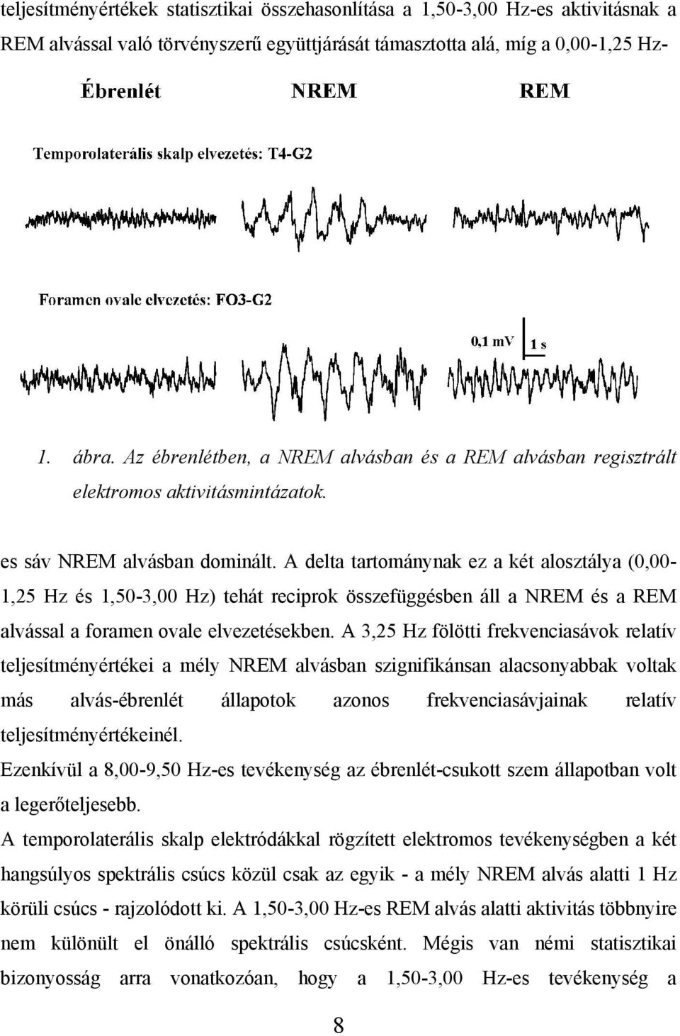 A delta tartománynak ez a két alosztálya (0,00-1,25 Hz és 1,50-3,00 Hz) tehát reciprok összefüggésben áll a NREM és a REM alvással a foramen ovale elvezetésekben.