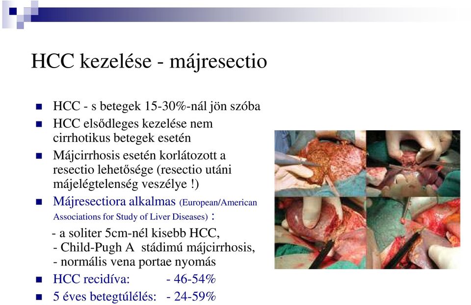 ) Májresectiora alkalmas (European/American Associations for Study of Liver Diseases) : - a soliter 5cm-nél