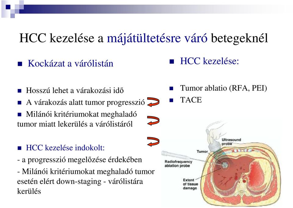 lekerülés a várólistáról Tumor ablatio (RFA, PEI) TACE HCC kezelése indokolt: - a progresszió