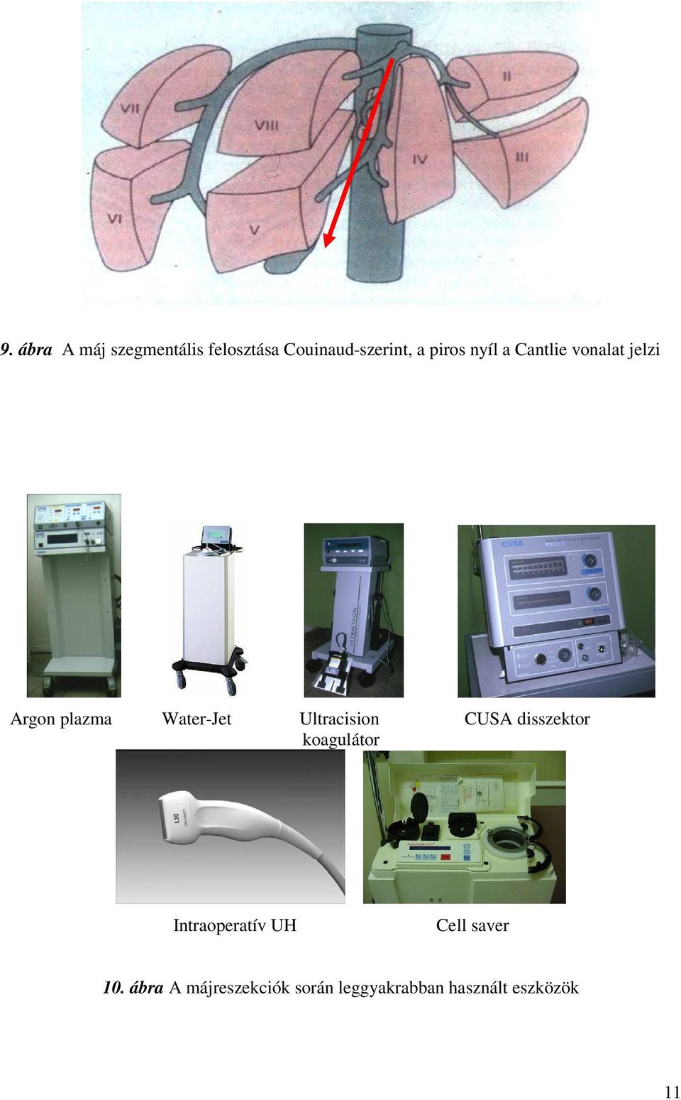 Ultracision CUSA disszektor koagulátor Intraoperatív UH Cell