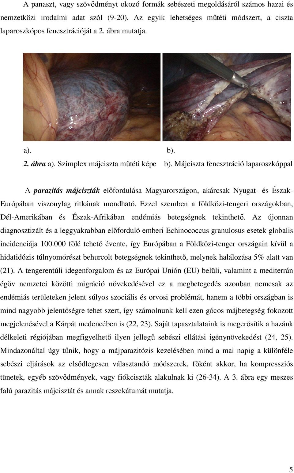 A parazitás májciszták elıfordulása Magyarországon, akárcsak Nyugat- és Észak- Európában viszonylag ritkának mondható.