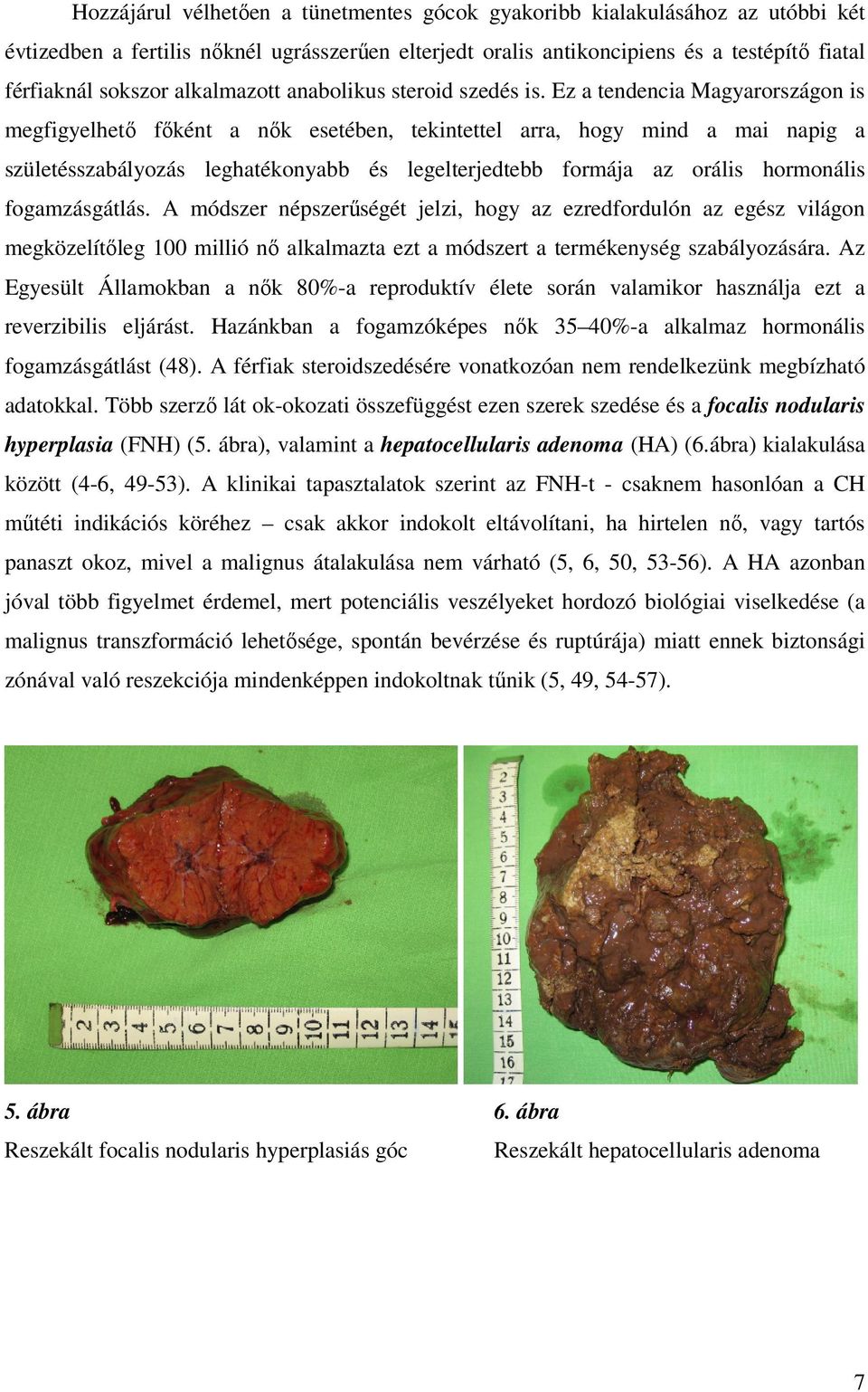 Ez a tendencia Magyarországon is megfigyelhetı fıként a nık esetében, tekintettel arra, hogy mind a mai napig a születésszabályozás leghatékonyabb és legelterjedtebb formája az orális hormonális