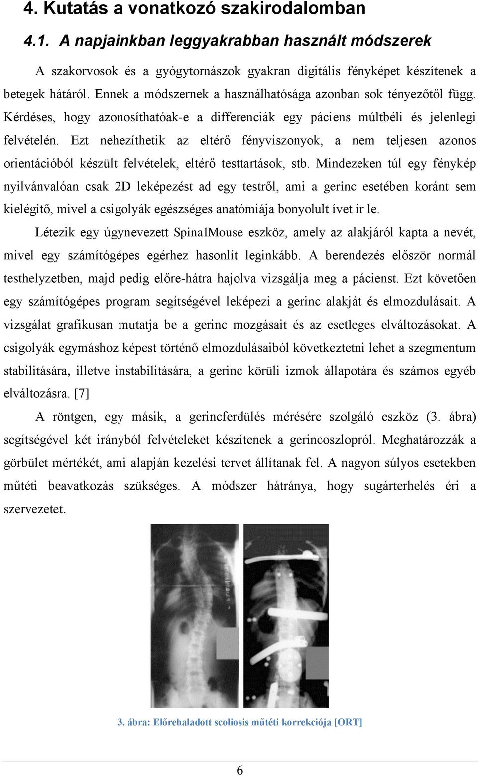 Ezt nehezíthetik az eltérő fényviszonyok, a nem teljesen azonos orientációból készült felvételek, eltérő testtartások, stb.