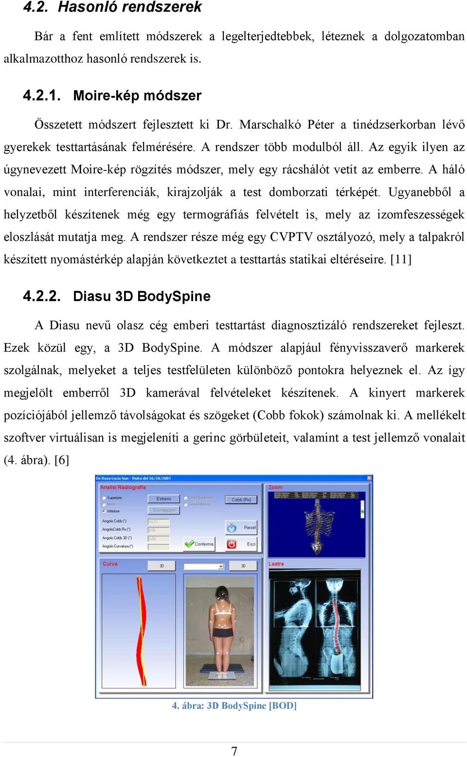 Az egyik ilyen az úgynevezett Moire-kép rögzítés módszer, mely egy rácshálót vetít az emberre. A háló vonalai, mint interferenciák, kirajzolják a test domborzati térképét.