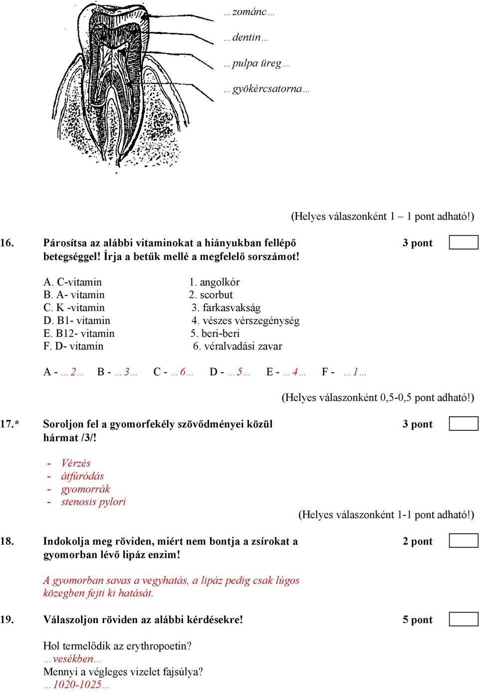 véralvadási zavar A - 2 B - 3 C - 6 D - 5 E - 4 F - 1 (Helyes válaszonként 0,5-0,5 pont adható!) 17.* Soroljon fel a gyomorfekély szövődményei közül 3 pont hármat /3/!