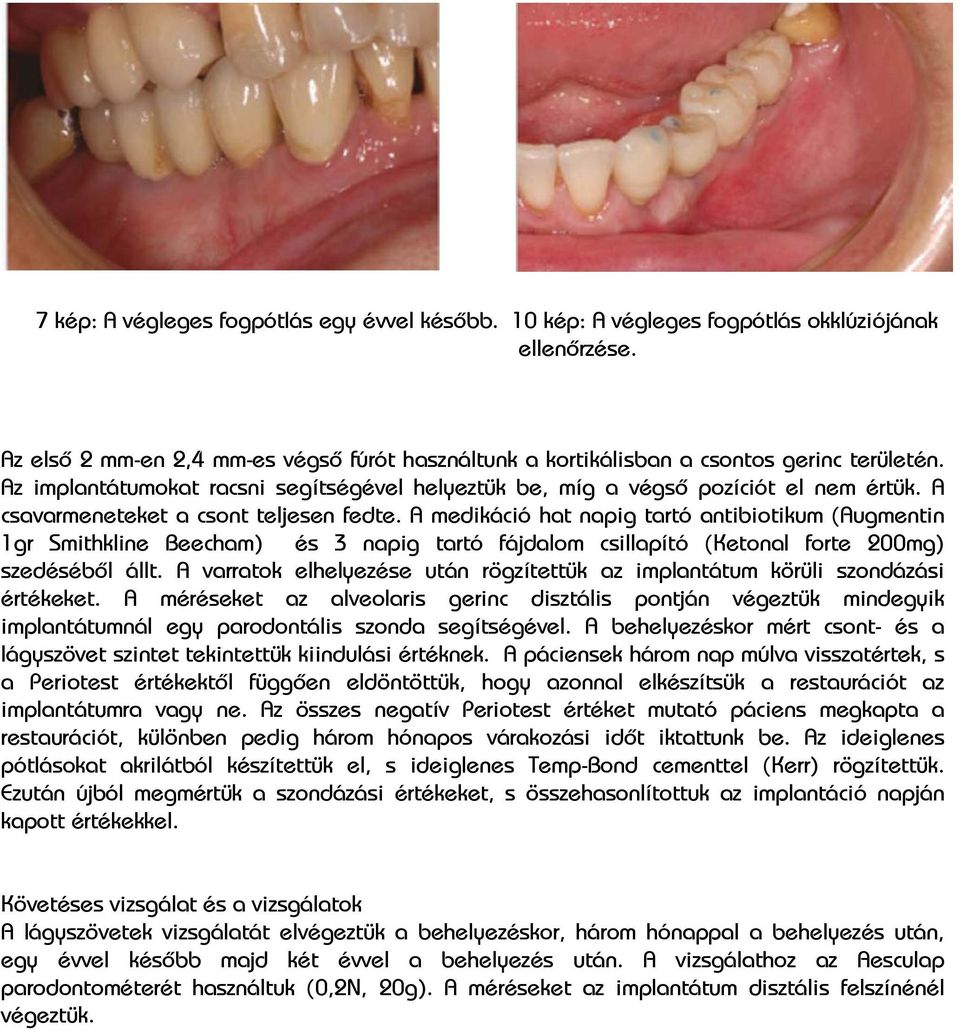 A medikáció hat napig tartó antibiotikum (Augmentin 1gr Smithkline Beecham) és 3 napig tartó fájdalom csillapító (Ketonal forte 200mg) szedéséből állt.