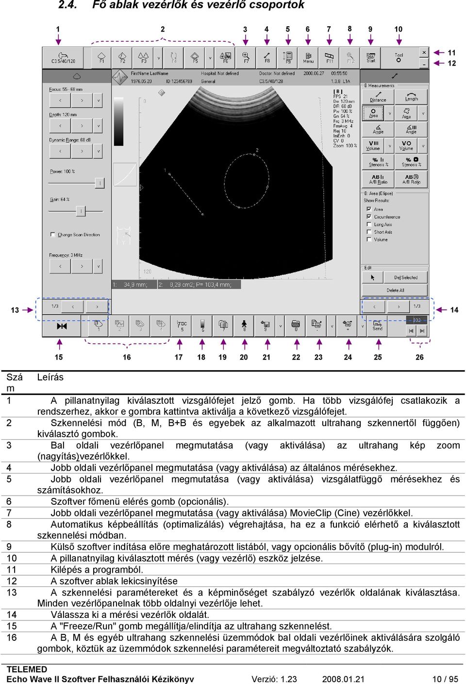 2 Szkennelési mód (B, M, B+B és egyebek az alkalmazott ultrahang szkennertől függően) kiválasztó gombok.