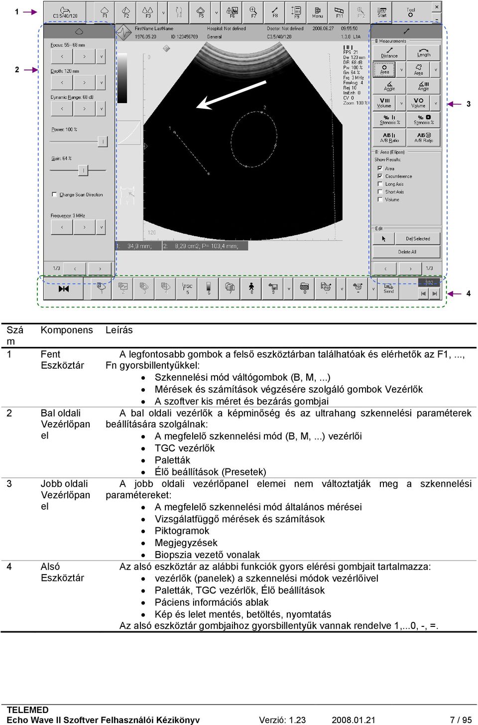 ..) Mérések és számítások végzésére szolgáló gombok Vezérlők A szoftver kis méret és bezárás gombjai A bal oldali vezérlők a képminőség és az ultrahang szkennelési paraméterek beállítására